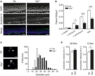 Changes in Ionic Conductance Signature of Nociceptive Neurons Underlying Fabry Disease Phenotype